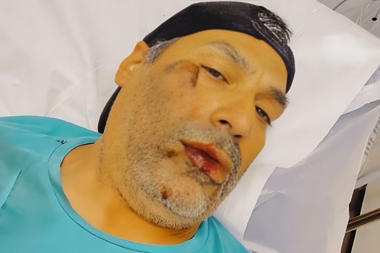 Agente de trânsito de Brumado se fere após queda de bicicleta em avenida Centenário