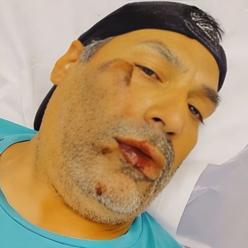 Agente de trânsito de Brumado se fere após queda de bicicleta em avenida Centenário