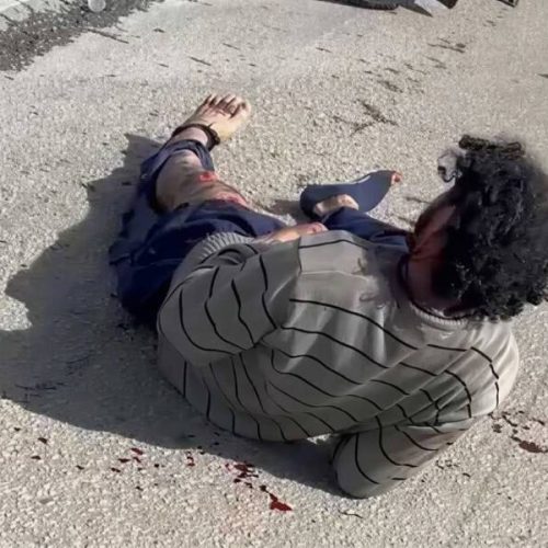 Andarilho é atropelado por motocicleta no Anel Viário e deixa local antes da chegada do socorro