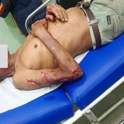 Briga entre cunhados termina com homem ferido após agressão com barra de ferro em Palmas de Monte Alto