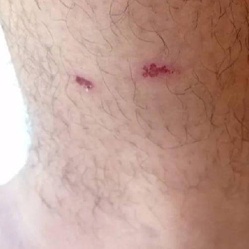 Homem é atacado por cães de rua enquanto ia trabalhar em Brumado; episódio assusta moradores