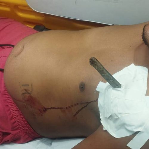 Homem é ferido com faca no peito durante discussão com ex-companheira na Bahia