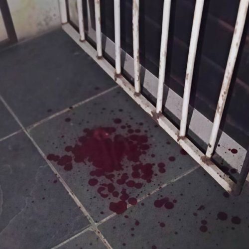 Mulher é espancada dentro de casa em Guanambi e suspeito foge antes da polícia chegar