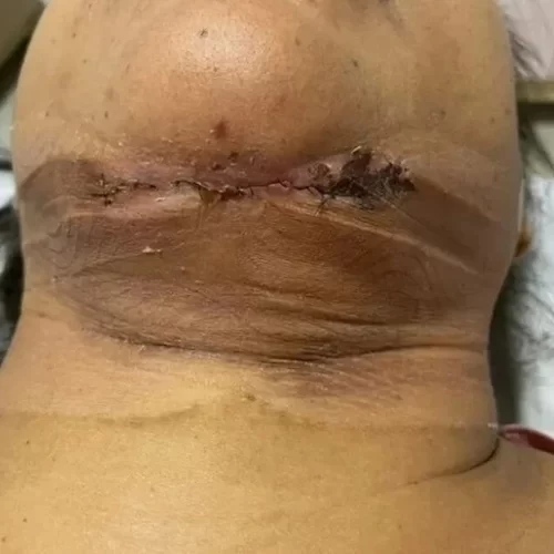 Polícia indicia dentista por lesão grave e exercício ilegal da medicina em Vitória da Conquista