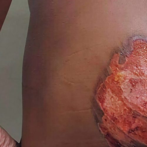 Polícia prende suspeitos de tortura contra jovem com deficiência em Livramento