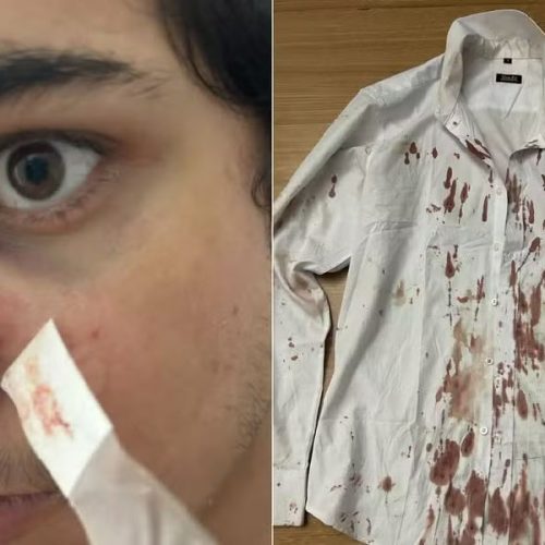 Turista relata agressão durante assalto no Festival Virada Salvador e diz que réveillon virou “pesadelo”