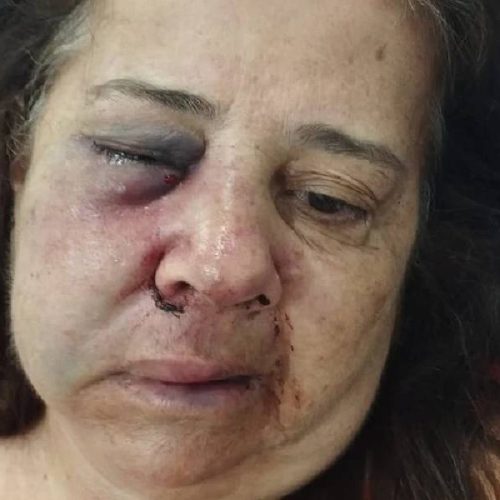 Violência chocante: idosa é brutalmente espancada ao negar venda de bebida a cliente bêbado em Brumado