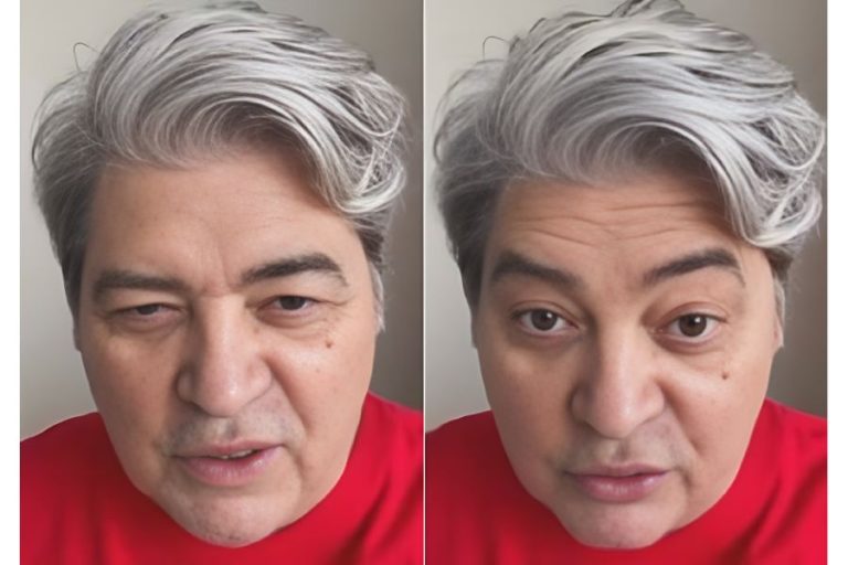 Datena passa por cirurgia no coração, diz que quadro era grave e faz alerta sobre diabetes