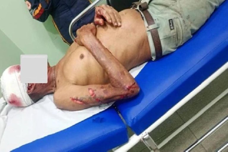 Briga entre cunhados termina com homem ferido após agressão com barra de ferro em Palmas de Monte Alto