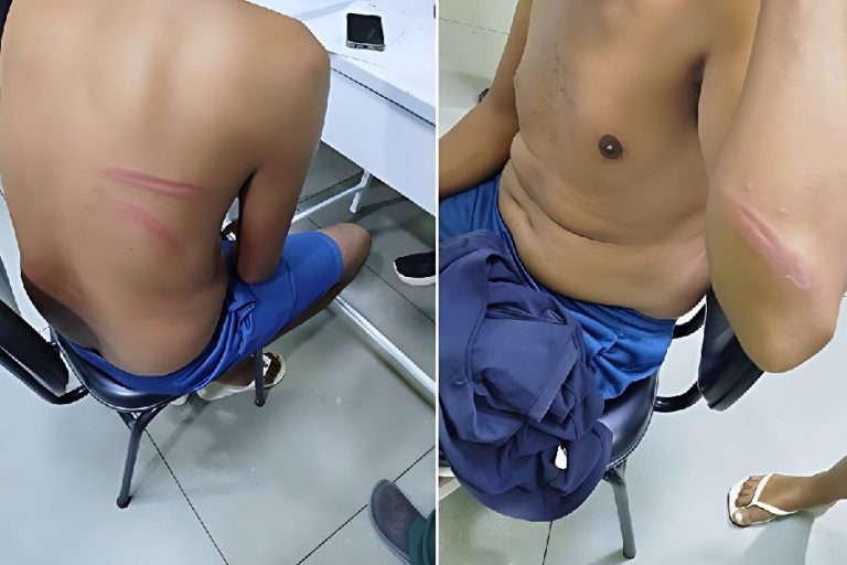 Homem denuncia agressão e injúria no centro de Palmas de Monte Alto