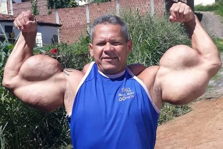 Morre aos 55 anos o ‘Popeye Brasileiro’, conhecido por modificações corporais extremas