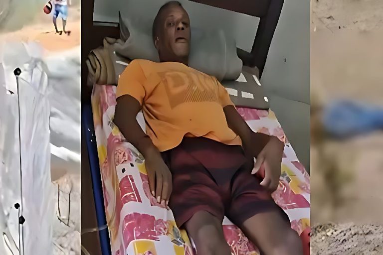 Pedreiro ferido após acidente com carreta de gado em Malhada pede ajuda para continuar tratamento