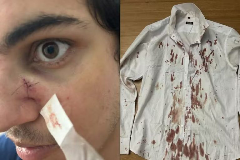 Turista relata agressão durante assalto no Festival Virada Salvador e diz que réveillon virou “pesadelo”