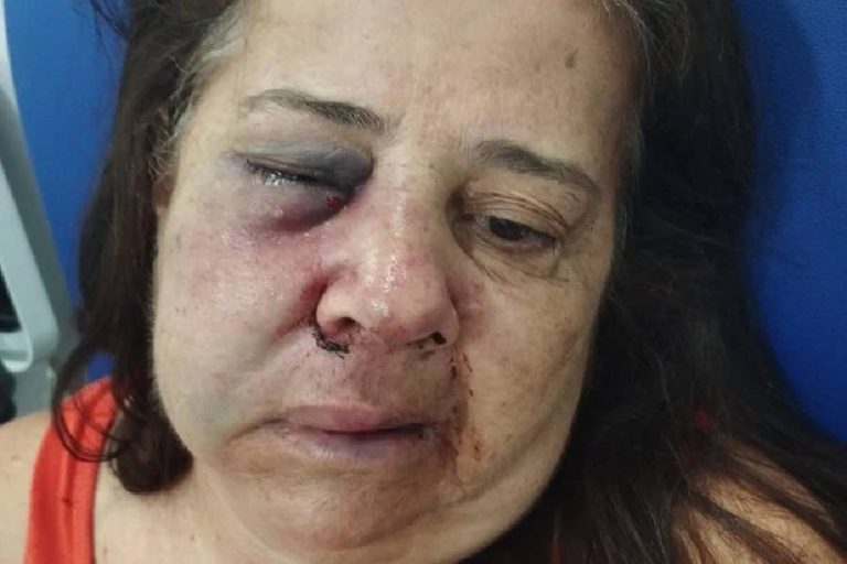 Violência chocante: idosa é brutalmente espancada ao negar venda de bebida a cliente bêbado em Brumado
