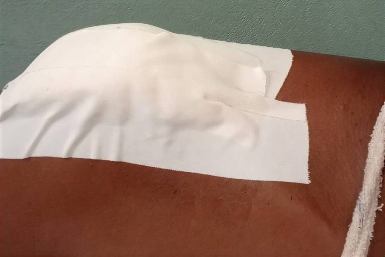 Paciente denuncia falta de curativo na UPA de Guanambi e secretaria explica limitações do serviço