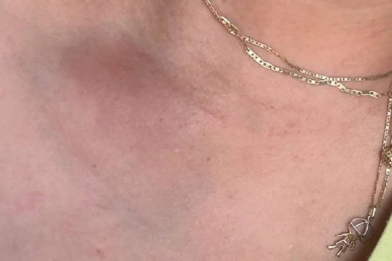 Vereador é acusado de agressão por ex-mulher em Rio do Antônio; ele nega acusações