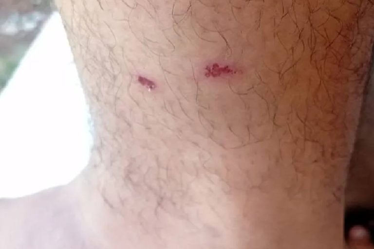 Homem é atacado por cães de rua enquanto ia trabalhar em Brumado; episódio assusta moradores