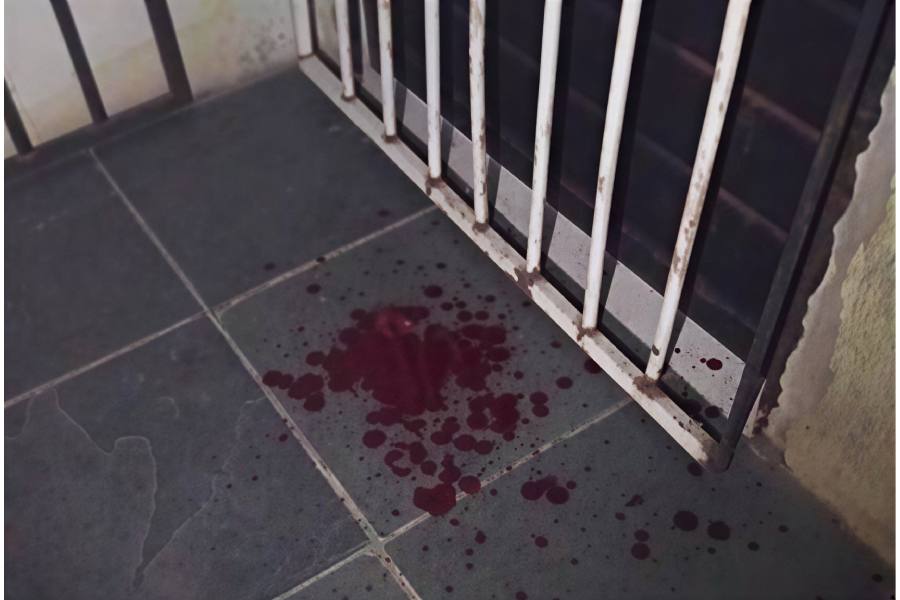 Mulher é espancada dentro de casa em Guanambi e suspeito foge antes da polícia chegar