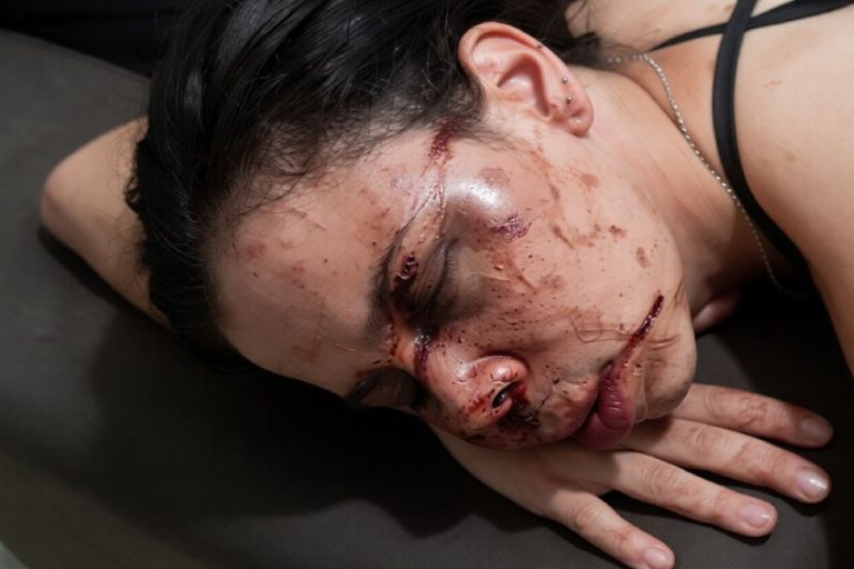 Espancamento brutal dentro de casa termina com mulher ferida e agressor condenado em Brumado