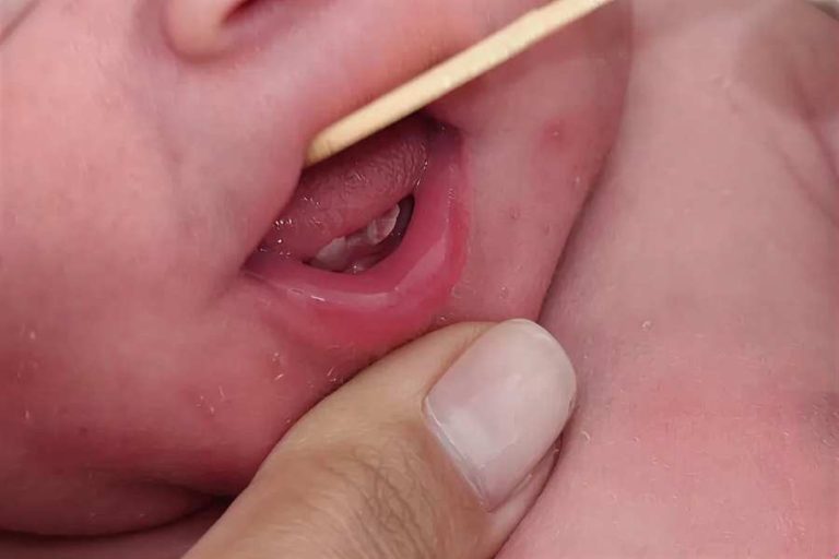 Bebê nasce com dois dentes e surpreende família e equipe médica em Brumado