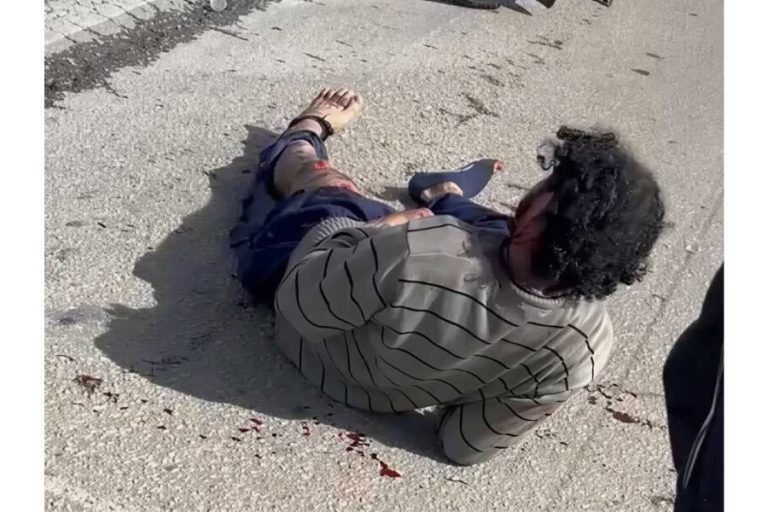 Andarilho é atropelado por motocicleta no Anel Viário e deixa local antes da chegada do socorro