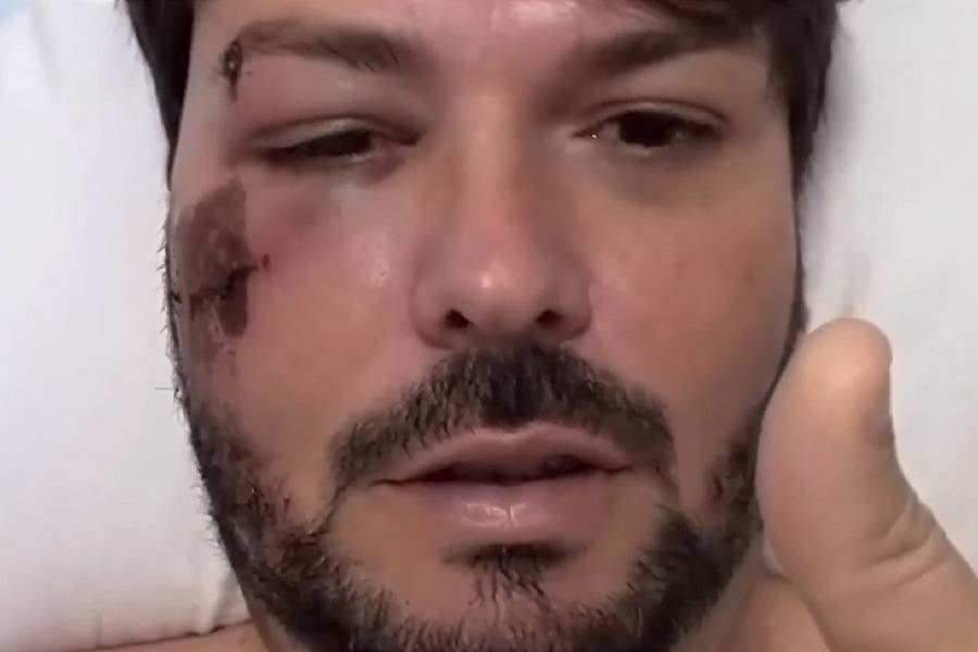 Prefeito de Encruzilhada passa por cirurgia após acidente de bicicleta e segue internado