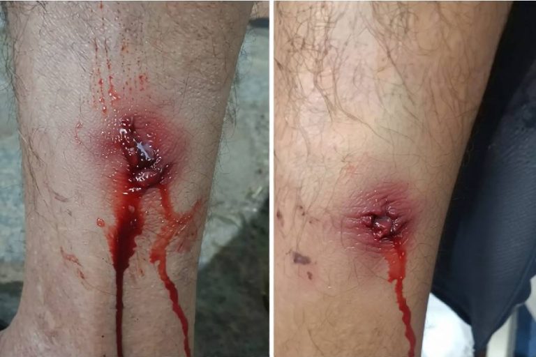 Ataques de cães deixam duas pessoas feridas em avenida de Livramento