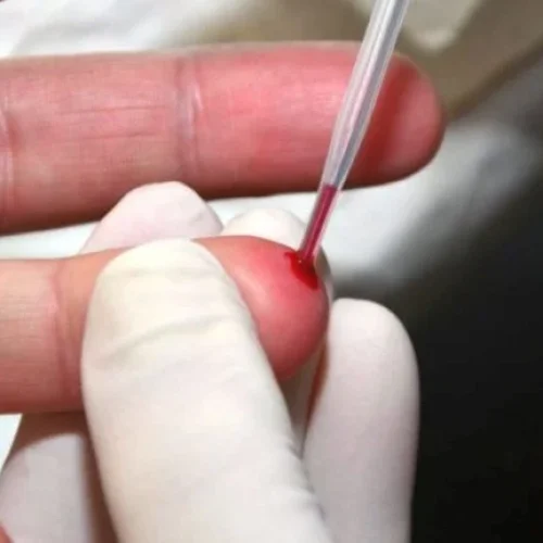 Prefeitura de Brumado reforça combate às hepatites virais com foco na prevenção e testagem durante o Julho Amarelo