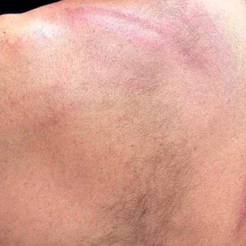 Empresário é espancado por seguranças na festa “Melhor Feijão” em Vitória da Conquista
